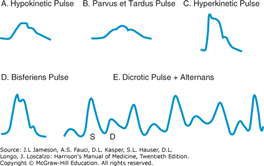 Pulsus parvus et tardus wiki