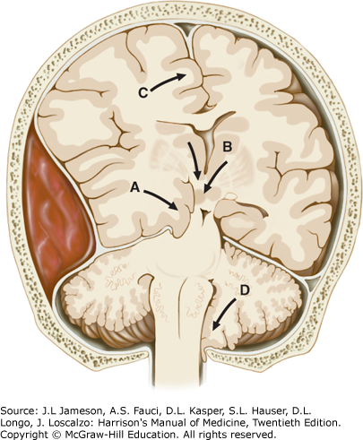 hmom20_ch21_f001.png