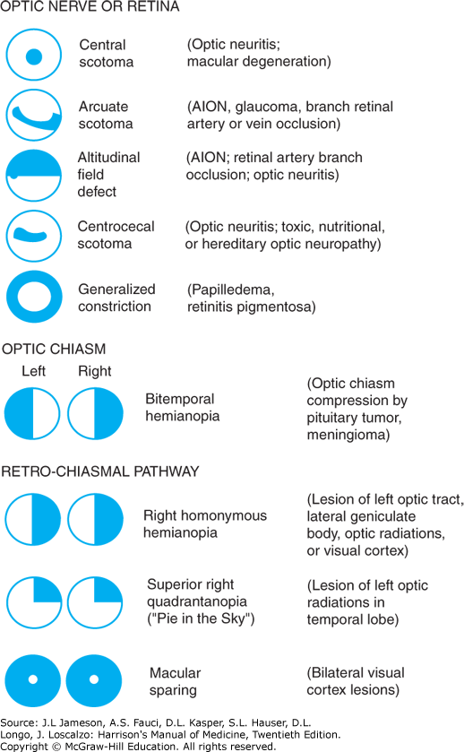 Chapter 54 Acute Visual Loss and Double Vision Harrison's Manual of